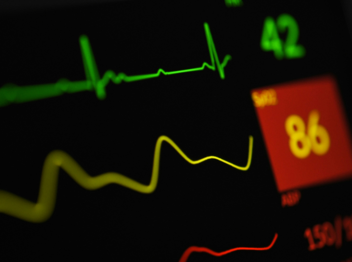 AI심장카메라 이미지3